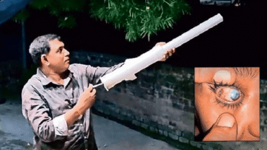 calcium carbide gun eye injuries during Diwali